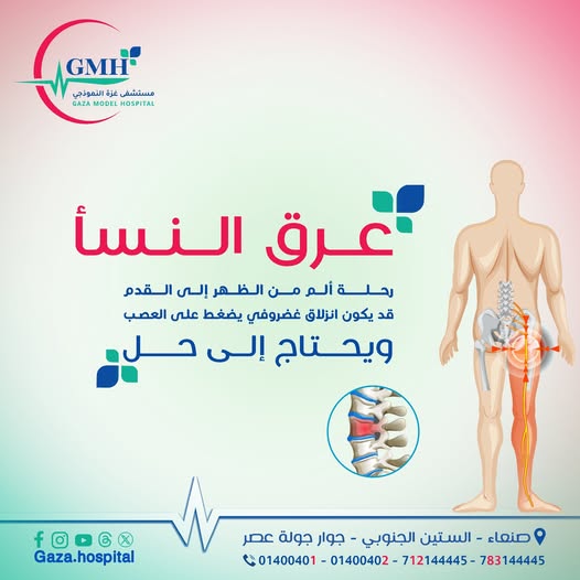 عرق النسا — رحلة ألم من الظهر إلى القدم