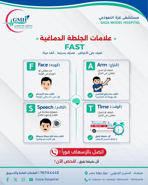 علامات الجلطة الدماغية — FAST